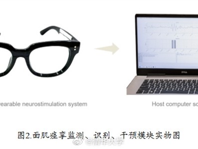 不打针不手术 清华大学发明神奇眼镜 戴上就能治疗面部痉挛 ！