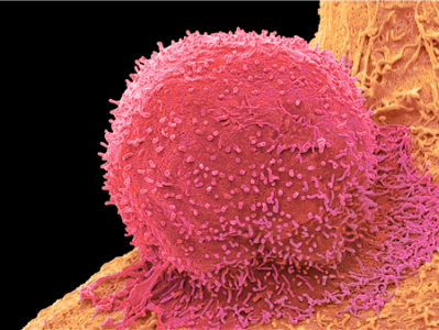 研究发现大腿粗的人或自带抗癌优势：这才是宝藏身材 ！